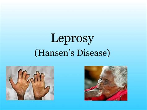LEPROSY pathophysiology hansen's disease | PPTX