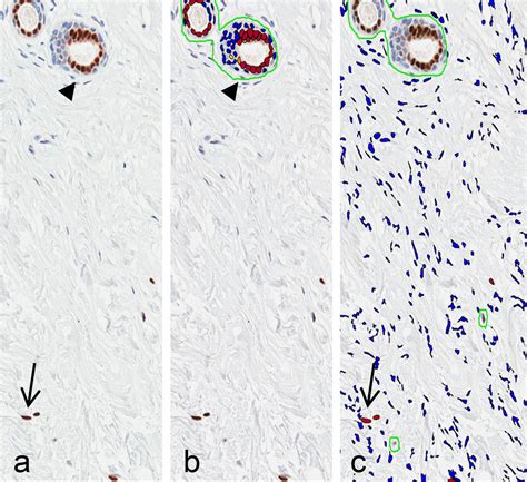 Image result for IHC Staining
