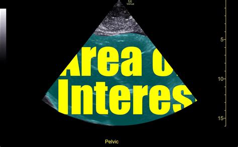 Image result for Ultrasound Scanner Depth Control