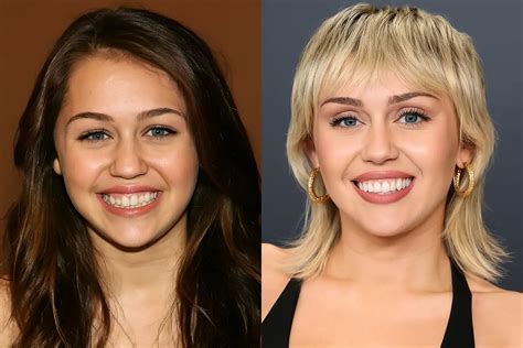 Miley Cyrus and Veneers: A Celebrity Smile Transformation Guide ...