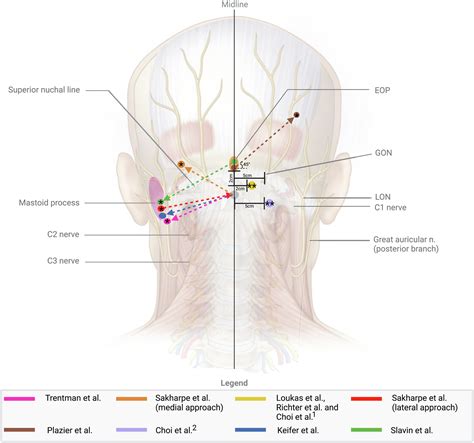 Occipital Neuralgia Treatment