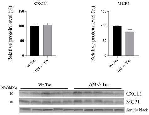 Effect of Tff3 Deficiency and ER Stress in the Liver