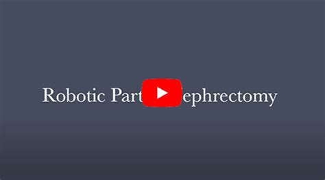 Image result for Robotic Partial Nephrectomy Video Animation