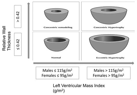 Dilated ventricle, low EF, with concentric hypertrophy? : r/Cardiology