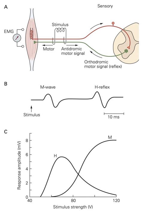 Hyperactive Reflexes 的图像结果