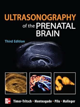 Buy Ultrasonography of the Prenatal Brain Book Online at Low Prices in ...