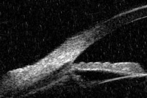 Angle Recession 的图像结果