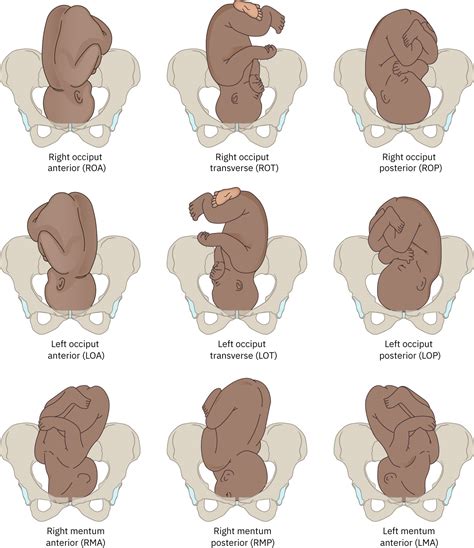 10.4 The P's of Labor - Nursing Health Promotion
