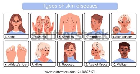 Image result for Different Types of Skin Conditions