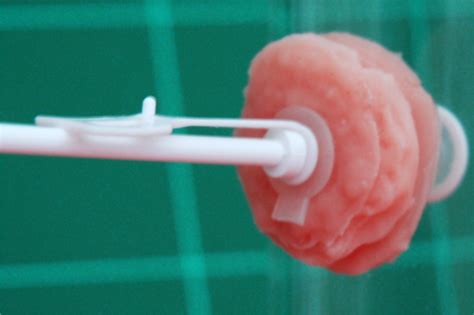 Stimmprothese » Prothesenstopfen