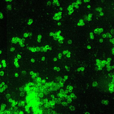 Free picture: francisella, tularensis, direct, fluorescent, antibody, stain