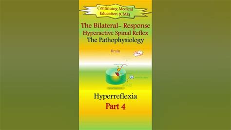 Hyperactive Reflexes 的图像结果