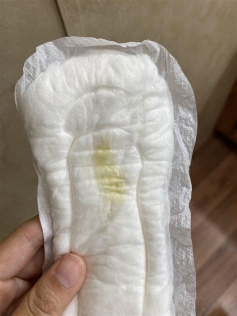 I have yellow discharge. Is that normal? : r/Healthyhooha