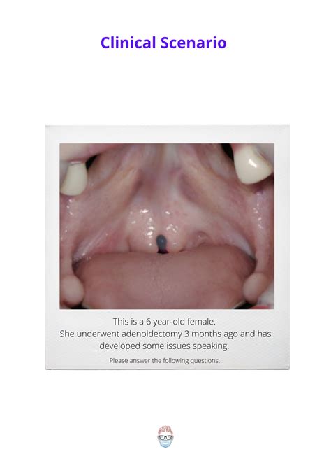 Velopharyngeal Insufficiency - Clinical Case