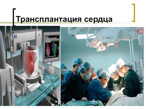 Трансплантация органов и тканей презентация, доклад