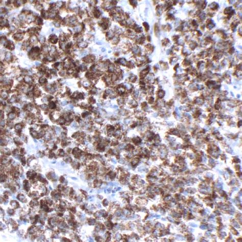AMACR - BOFAP | Pathnsitu Biotechnologies