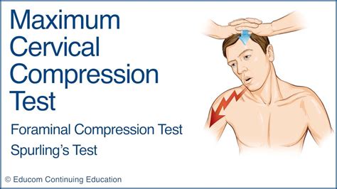 Image result for Max Cervical Compression Test