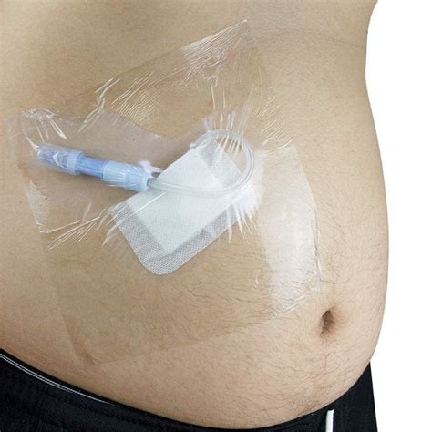 Buy NACHEN Peritoneal Waterproof Disposable Shower Shield, Catheter ...