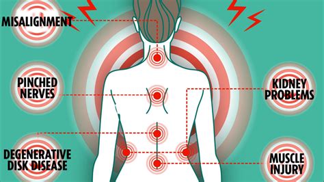 What the location of your back pain really means - from slipped discs to pinched nerves and ...