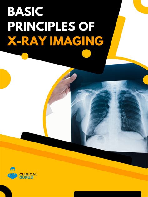 Image result for X-ray Tutorials