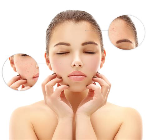 Understanding Pigmentation Causes | Prevent and Treat Skin Issues - Blog
