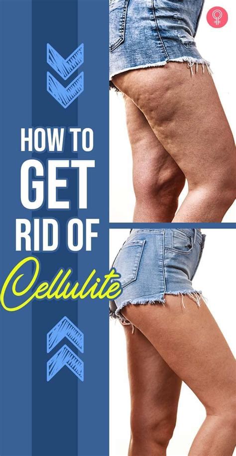 Image result for How to Remove Cellulite Fast