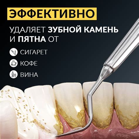 Скалер для зубов ультразвуковой для удаления зубного камня AsiaCare ...