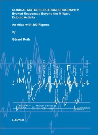 Buy Clinical Motor Electroneurography: Evoked Responses Beyond the M ...