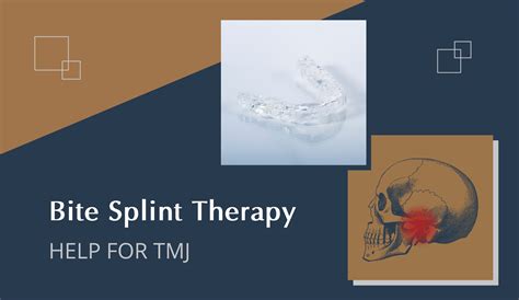 What Is Splint Therapy For Teeth Grinding at Steven Begay blog