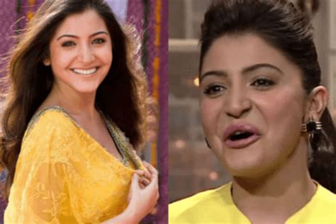 Anushka Sharma on lip job: I'm not going to lie and say I didn't ...