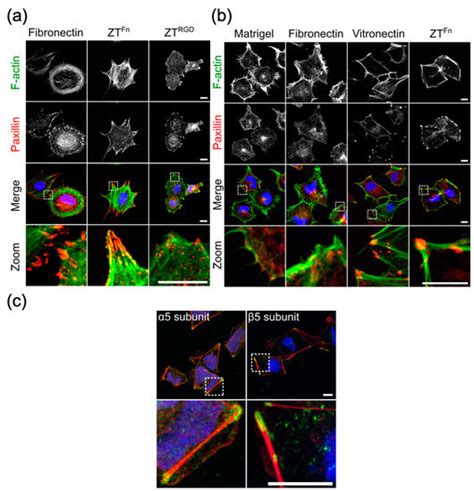 The ZT Biopolymer: A Self-Assembling Protein Scaffold for Stem Cell ...