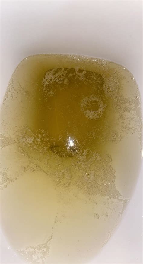 Bubbles In Urine Period at Brandon Myers blog