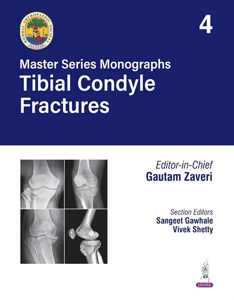 Buy BOS Master Series Monographs (Volume 4) Tibial Condyle Fractures ...