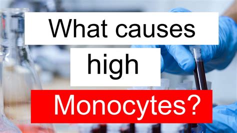 What causes high Monocytes and low Platelet count?