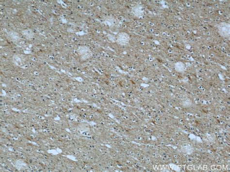 CHMP2B antibody (12527-1-AP) | Proteintech