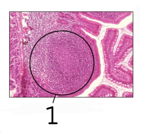 Image result for Small Intestine Lymph Nodes