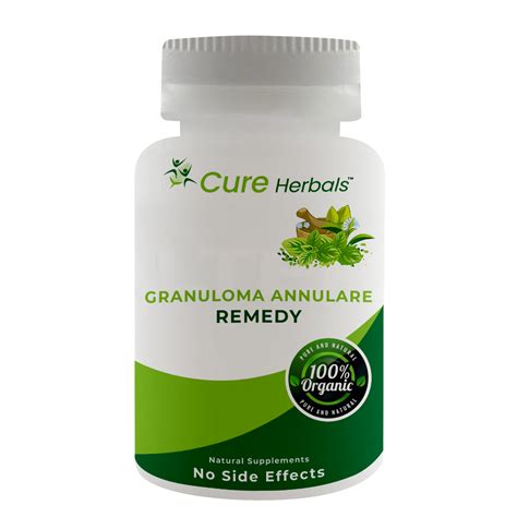 GRANULOMA ANNULARE HERBAL SUPPLEMENTS - Cure Herbals