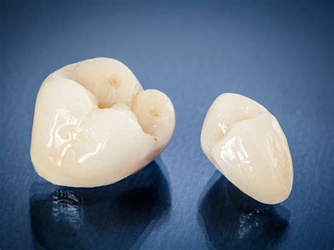 Beautiful Dental Crowns Restore Your Teeth & Your Smile