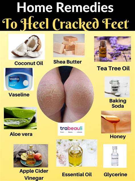 How To Heal Cracked Feet Overnight In Winter? - Best Beauty Lifestyle Blog | Homemade foot cream ...