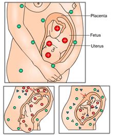 Image result for Rh Negative Targeted