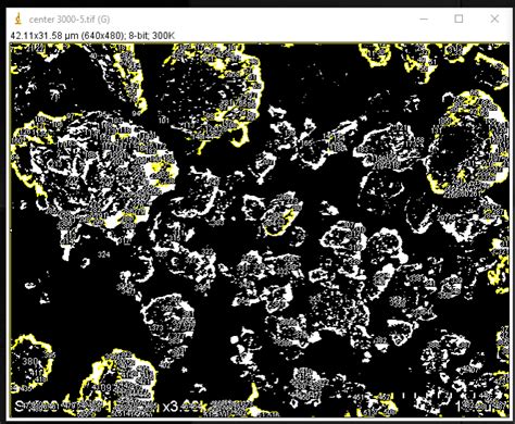 ImageJ Particle Size Distribution Tutorial 的图像结果