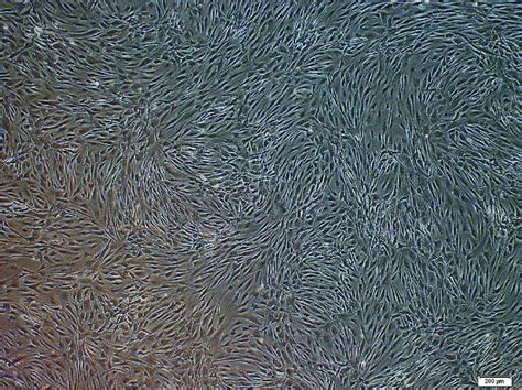 Spindle Shape 的图像结果