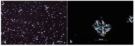 Aspergillus Section Fumigati Pneumonia and Oxalate Nephrosis in a Foal