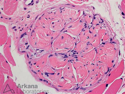 Golgi Tendon Organ | Neuro Notes | Arkana Laboratories