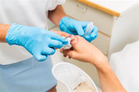 At-Home Wound Care Indicated Procedures Near Me | Mobile Wound Specialist