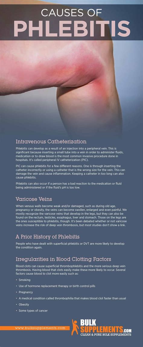 Infiltration Vs Phlebitis
