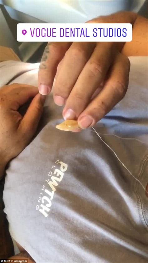 MAFS' Telv Williams documents his infected tooth extraction | Daily ...