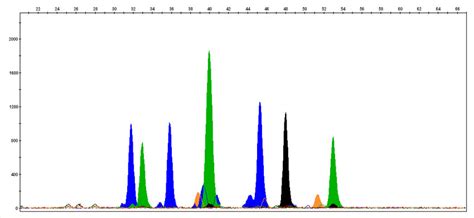 Electropherogram Interpretation 的图像结果