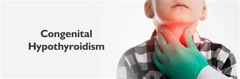 Congenital Hypothyroidism Congenital Hypothyroidism