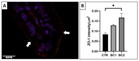 Intestine Health and Barrier Function in Fattening Rabbits Fed Bovine ...